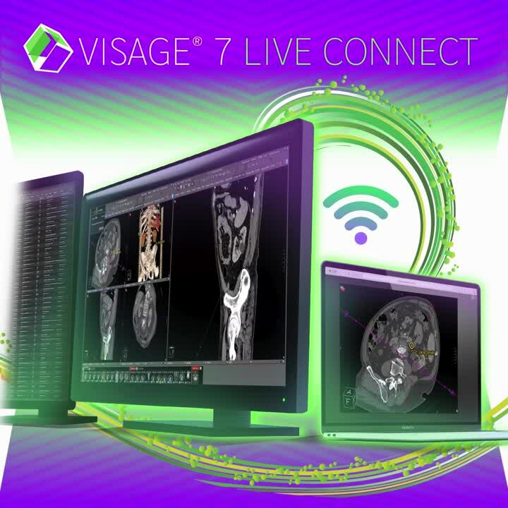Visage 7 Live Connect
