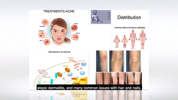 CAPTIONS STANDARD General Dermatology DTL promo video w Richard Usatine