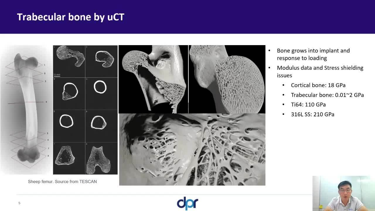 video: Next-generation medical implant design, production, and validation using additive manufacturing and nTop at Beijing DPR - English