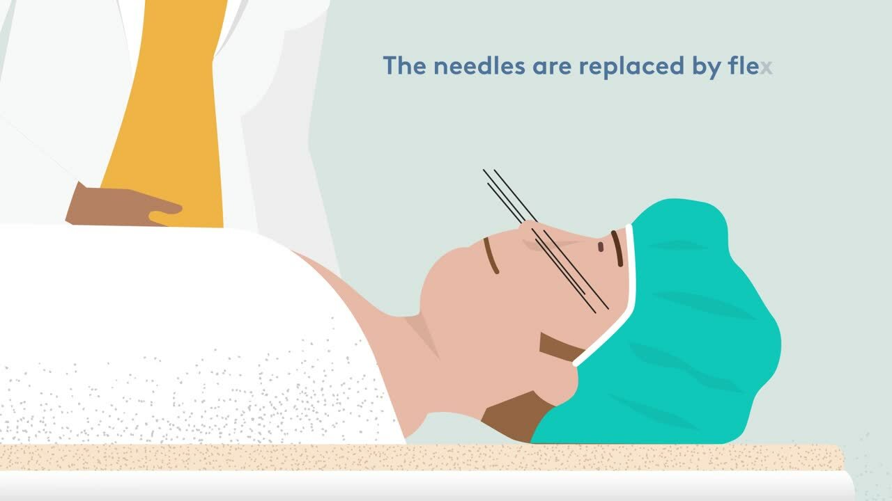 Thumbnail: cartoon of patient lying in bed with brachytherapy needles in their nose. Caption says 'The needles are replaced by flex...'