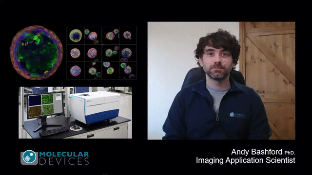 Imaging e analisi di un modello 3D delle vie respiratorie basato su organoidi